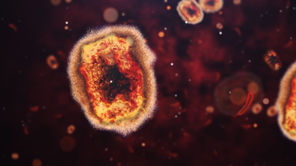Monkeypox may present with unusual symptoms, CDC warns - Livescience.com