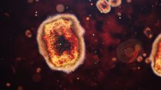 monkeypox viral particles