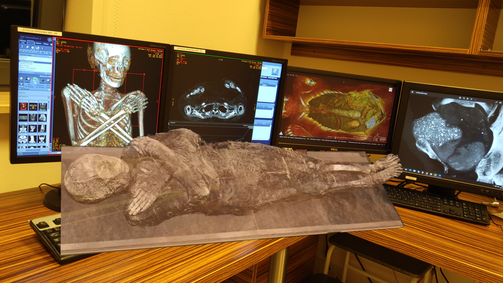 Image of virtual reality of a mummy projected in the foreground with four computer monitors in the background on a desk, each showing a different appearance from inside the mummy.