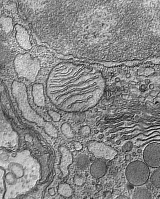 Captured using a transmission electron microscope, this image of a thin section of a single cell shows distinct cellular compartments and the structures within them.