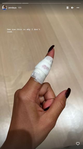 Zendaya's injured finger