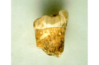 The neanderthal's first molar from which the clues were found. 