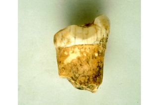 The neanderthal&#039;s first molar from which the clues were found. 