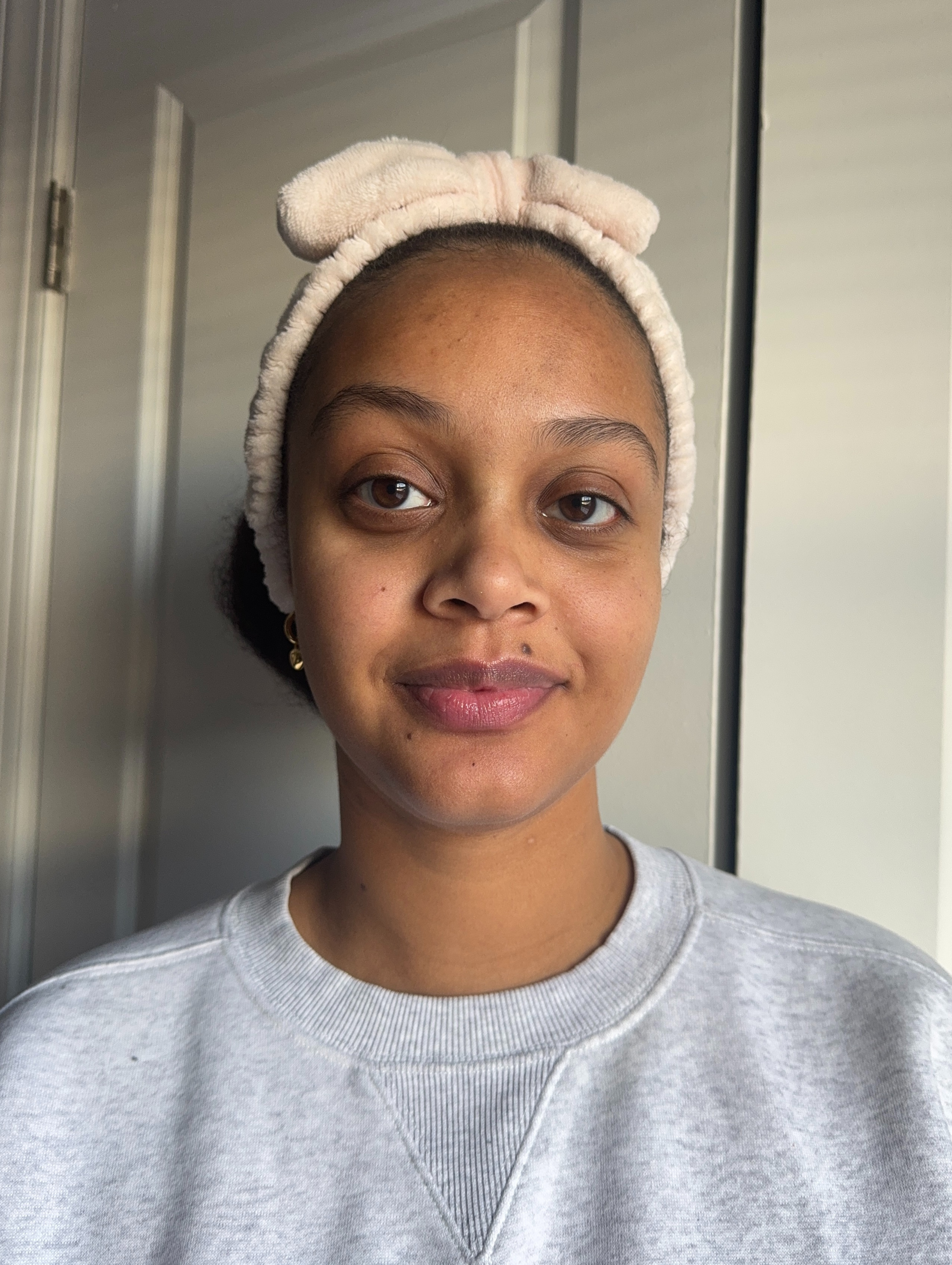 Shauna Beni-Haynes before and after testing Thayers's Milky Hydrating Toner