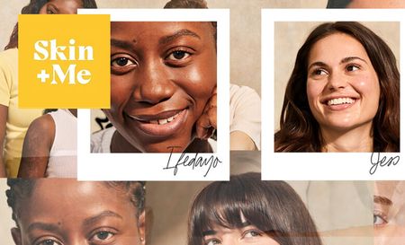 Skin and me logo top left with a collage of two women