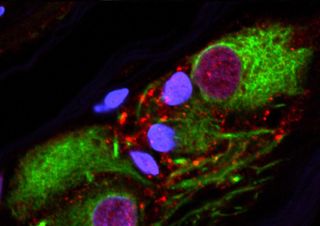 Clumps of alpha-synuclein protein (in red) were found in healthy appendixes. Those same clumps, when found in the brain, are a tell-tale signs of Parkinson's disease. 