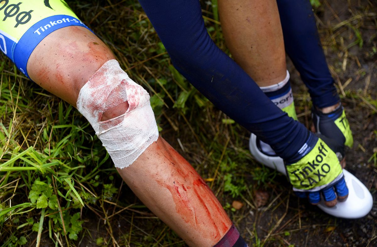 The bloodied and bandaged leg of Alberto Contador that ended his 2014 Tour