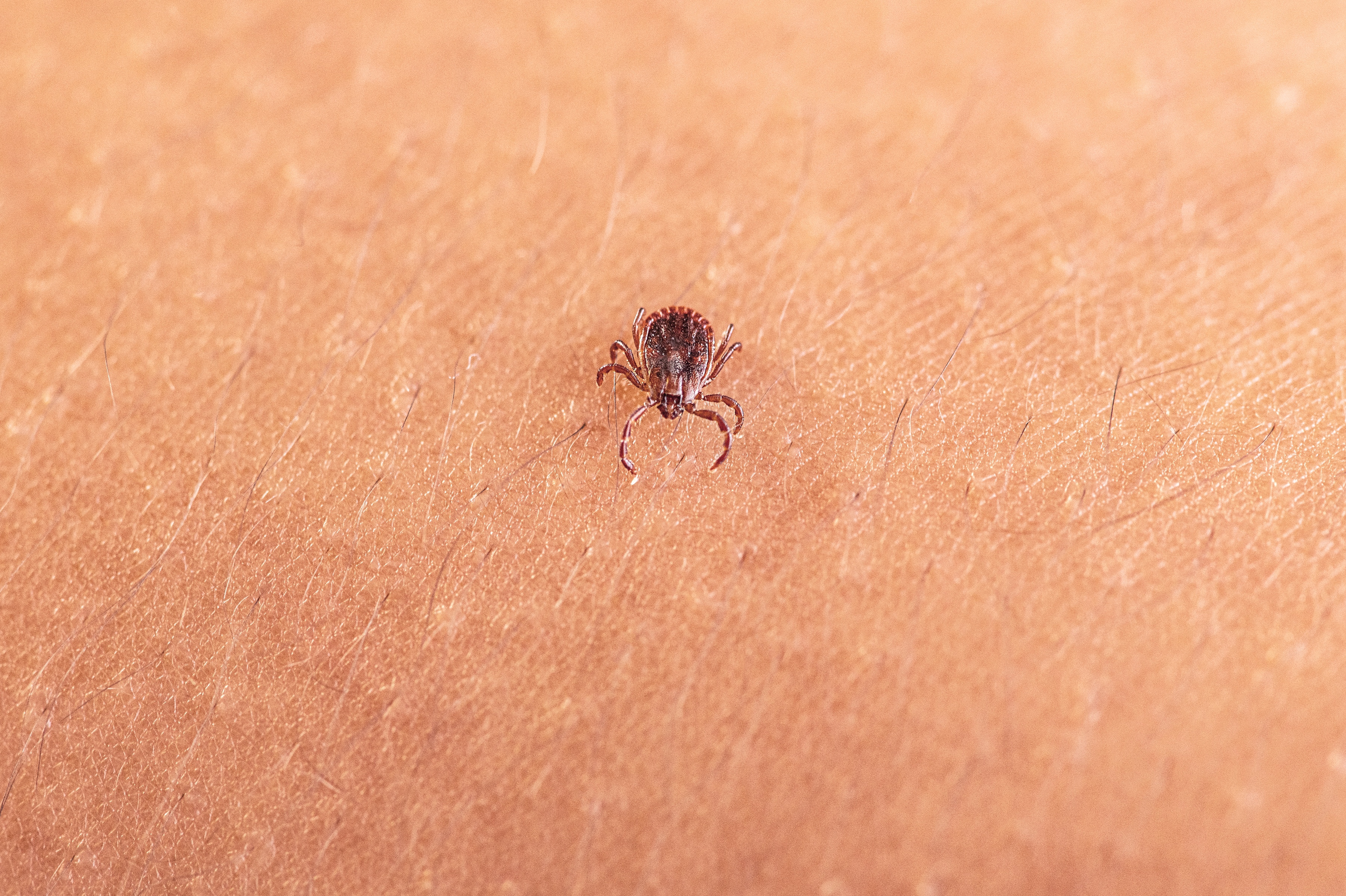 a tick on human skin
