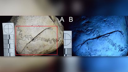 The injuries on the skull of the woman examined using both digital and ultraviolet light photography.