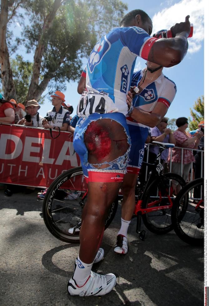 Lorrenzo Manzin (FDJ) missing a lot of skin
