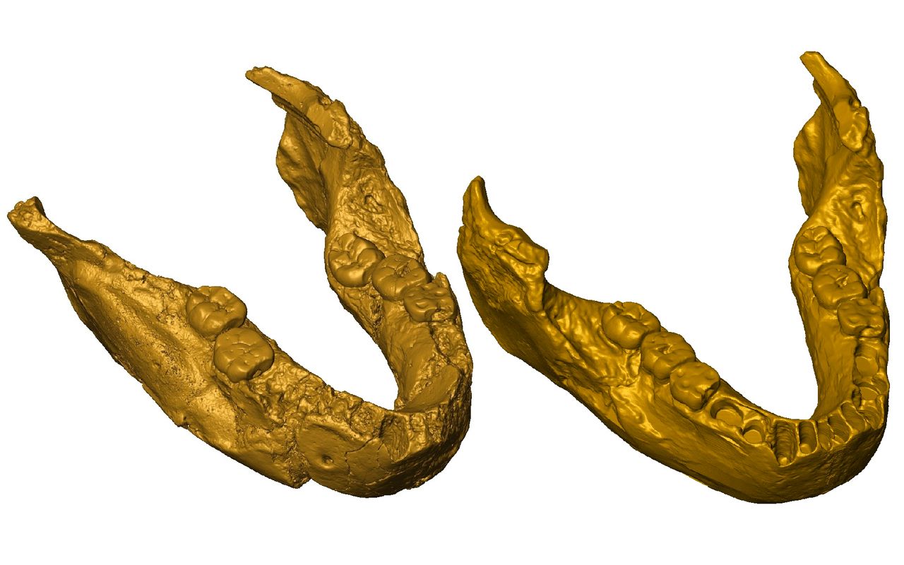 two digital models of a human-like jaw