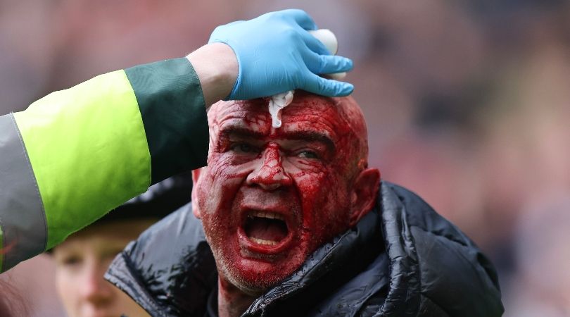 A fan with a bloodied face receives treatment after clashes between West Brom and Wolves supporters in the teams&#039; FA Cup tie in January 2024.