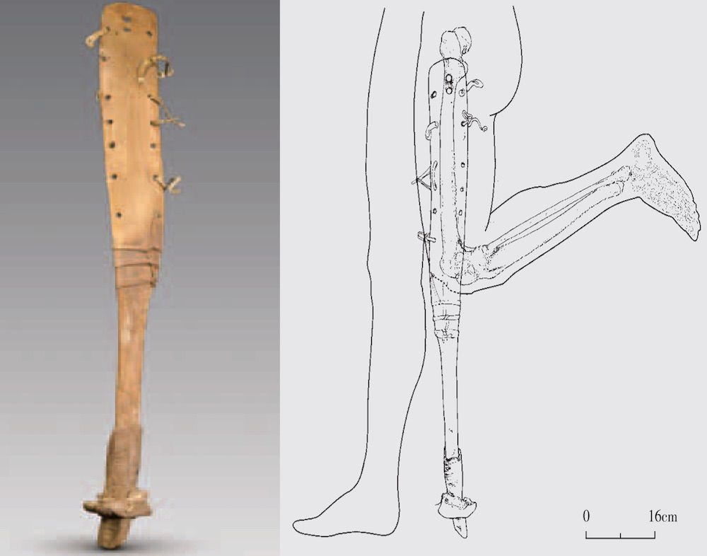 A 2,200-year-old prosthetic leg was discovered in a tomb in China and would&#039;ve been worn by a man with a deformed knee.