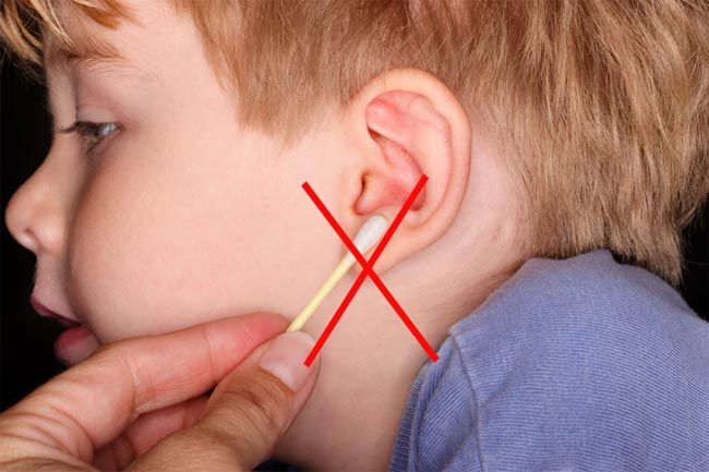 Now Hear This: Don't Remove Earwax