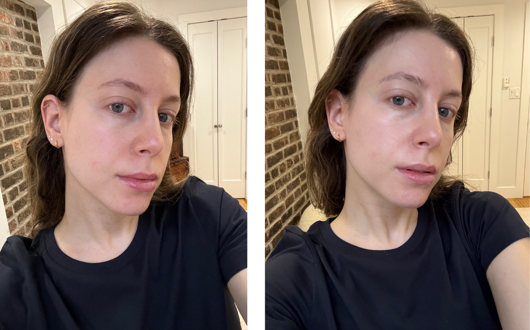Jamie Schneider before and after using Neurae's Treatment Lotion