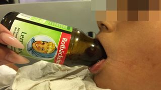 The boy had been drinking from a juice bottle when his tongue suddenly became stuck in the bottle's neck.