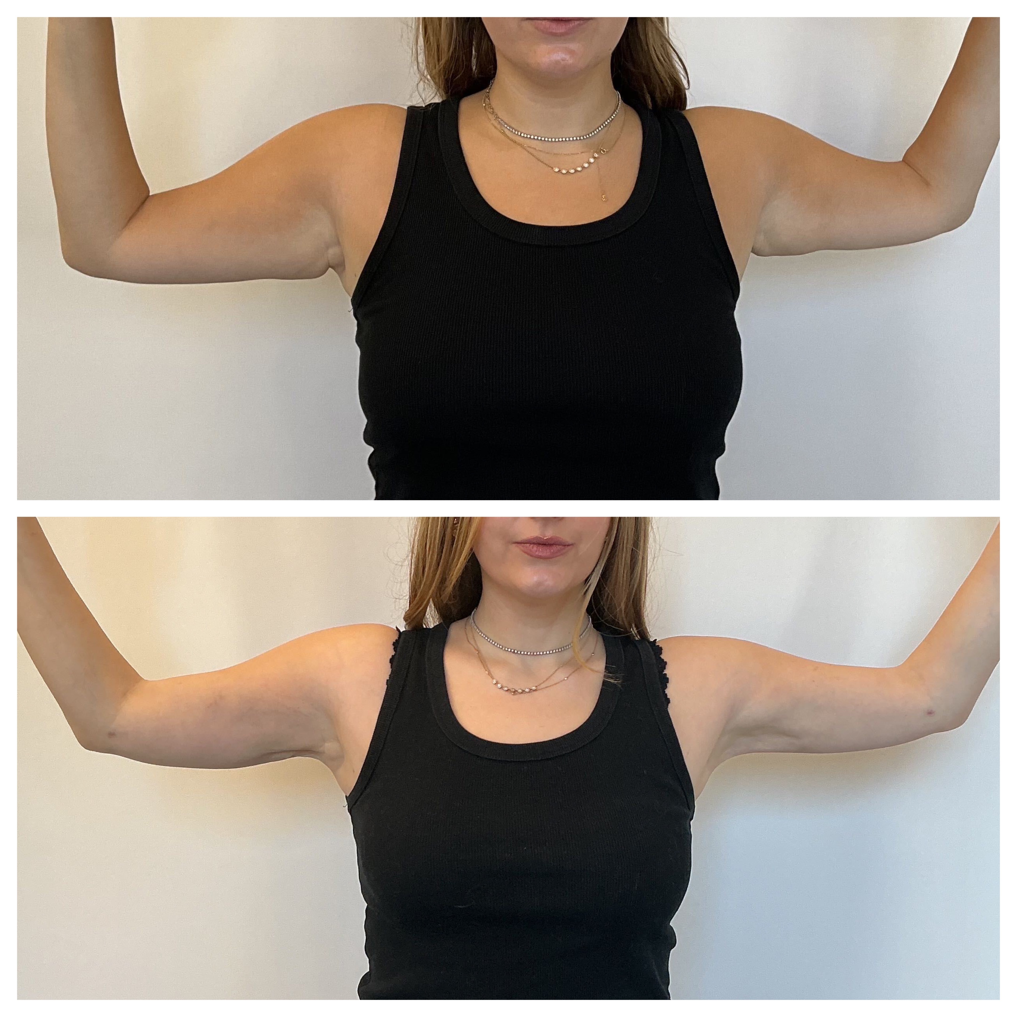 samantha holender before and after surgery