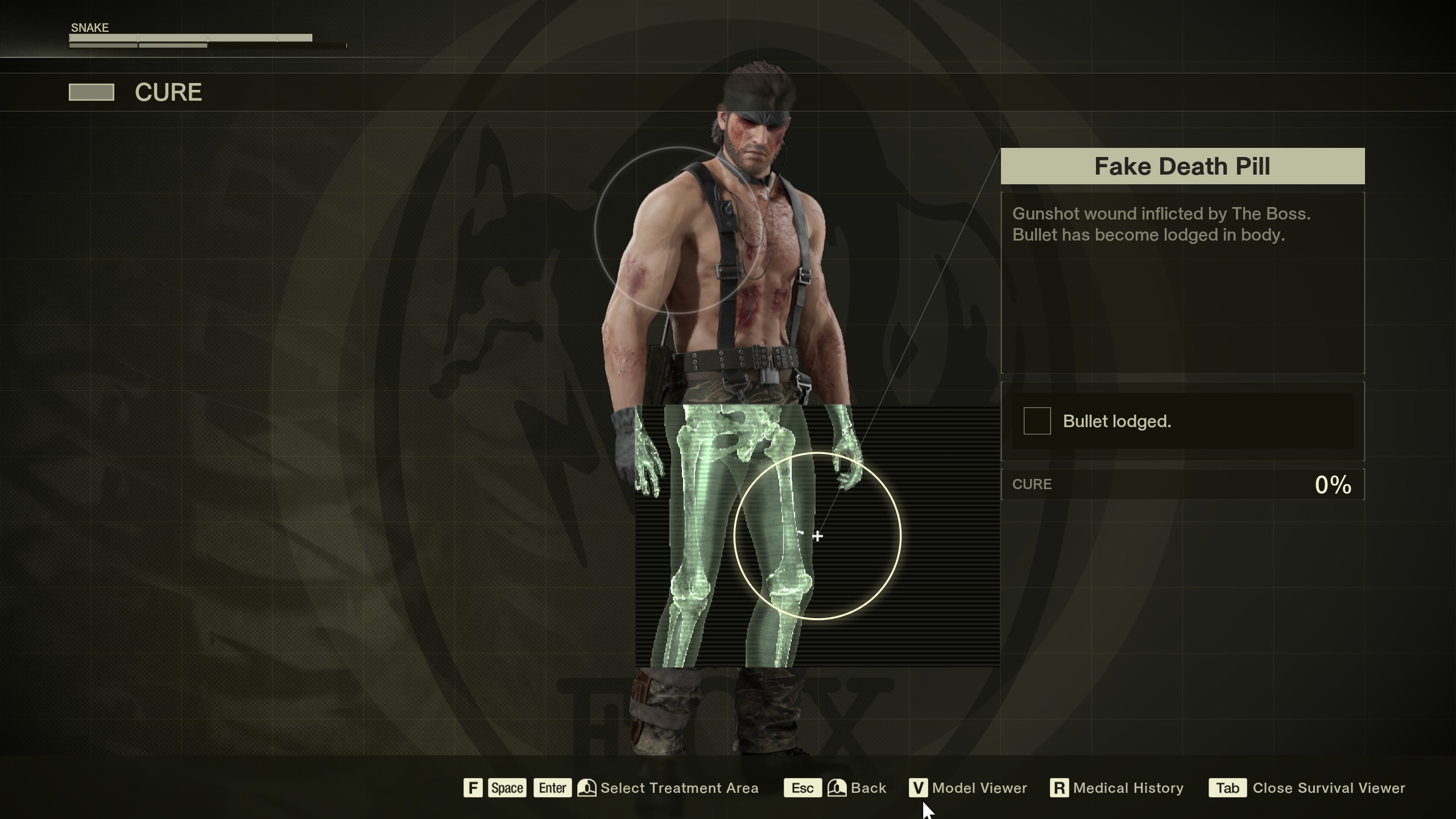 Metal Gear Solid Delta: Snake Eater prison - Death pill