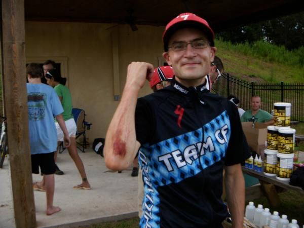A flesh wound for today's co-winner Christian Tanguy.