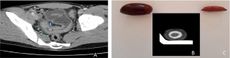 olive, ct scan