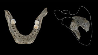 On the left, a human jaw is shown in occlusal (chewing) view; only three molars remain in the back. On the right, a fragment of a left human scapula is shown within a white outline of the bone; there appears to be a label stuck to it.