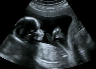 four month fetal ultrasound