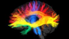 a colorful brain scan shows axons (wires) in a network that winds through the brain
