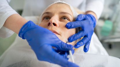 woman getting filler to treat acne scars 