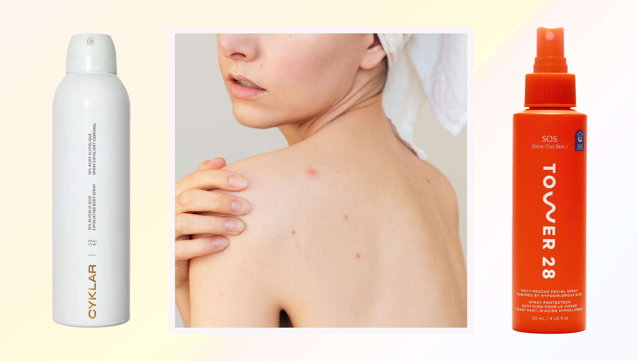 I Found the 10 Best Body Acne Products for the Chest, Back, Butt, and Wherever Else You're Breaking Out