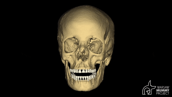A 3D animation of the Mysterious Lady's skull.