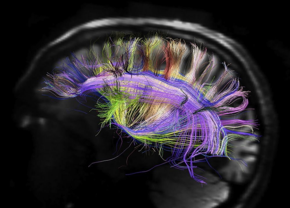 Grid structure of the human brain.