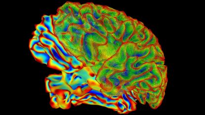 A new study used functional magnetic resonance imaging to show dramatic changes in the brain during pregnancy. Pregnancy increased gray matter loss and reshaped the default mode network, which is responsible for the mind wandering and a sense of identity.