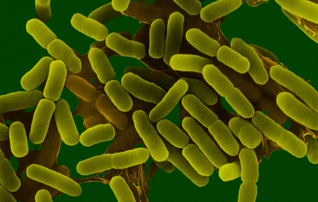 Coloured scanning electron micrograph (SEM) of Escherichia coli is a Gram-negative, facultatively anaerobic, enteric, rod prokaryote. This bacterium was isolated from the human intestine and is normally a part of the human and animal microbiota. Most E. c