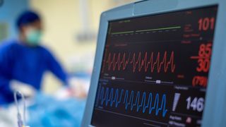 Stock photo of a heart monitor in an operating room.