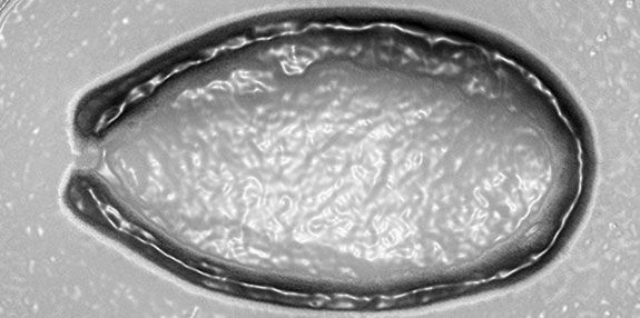 pandoravirus particle