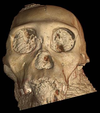 x-ray data reveals 3-d skull of human ancestor