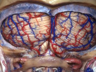 anatomy of the human brain, images of the human brain