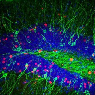 Fluorescently tagged neurons firing in the dentate gyrus