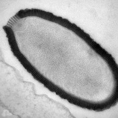 An ultrathin section of a Pithovirus particle in an infected Acanthamoeba castellanii cell.