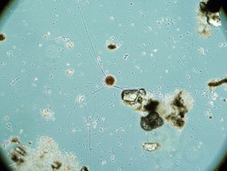 Single-celled foraminifera use hair-like pseudopods to move, eat and explore their environment.