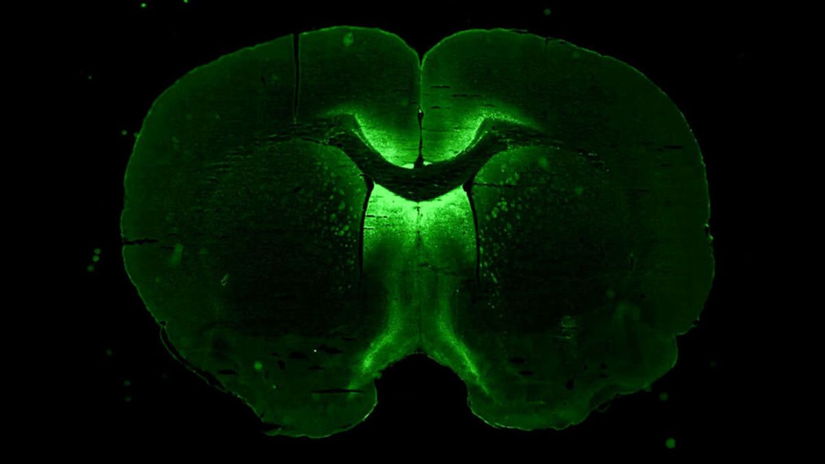 image shows glowing green tissue grown in a 3D shape; the green areas are neurons that have been exposed to a gene therapy