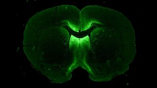 image shows glowing green tissue grown in a 3D shape; the green areas are neurons that have been exposed to a gene therapy