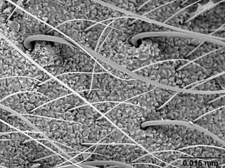 An electron microscope provides a close-up view of the crystalline hairs on the Radiohead ant. The function of the hairs is unknown.