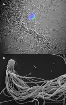 Sperm bundles of the desert ant <em>Cataglyphis savignyi</em>.