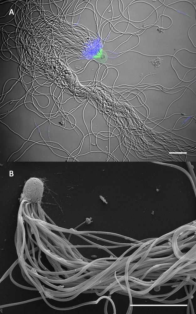 Sperm bundles of the desert ant &lt;em&gt;Cataglyphis savignyi&lt;/em&gt;.