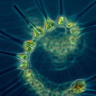 a microscope image of an organism with a spiky, spiraled shape and green color