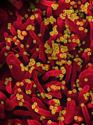 An electron microscopy image of monkey cells infected with the coronavirus shows filopodia (red) that allow viral particles (yellow) to infect nearby cells.