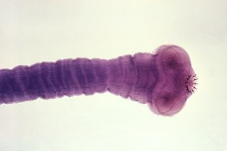 An adult Taenia scolium, the pork tapeworm. Humans become infected by ingesting raw or undercooked infected meat.