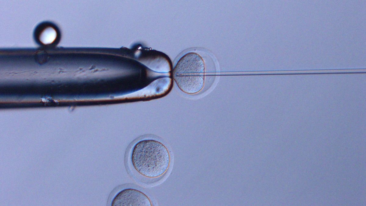 Space sperm were injected into oocytes. This method was called as Intracytoplasmic Sperm Injection (ICSI).