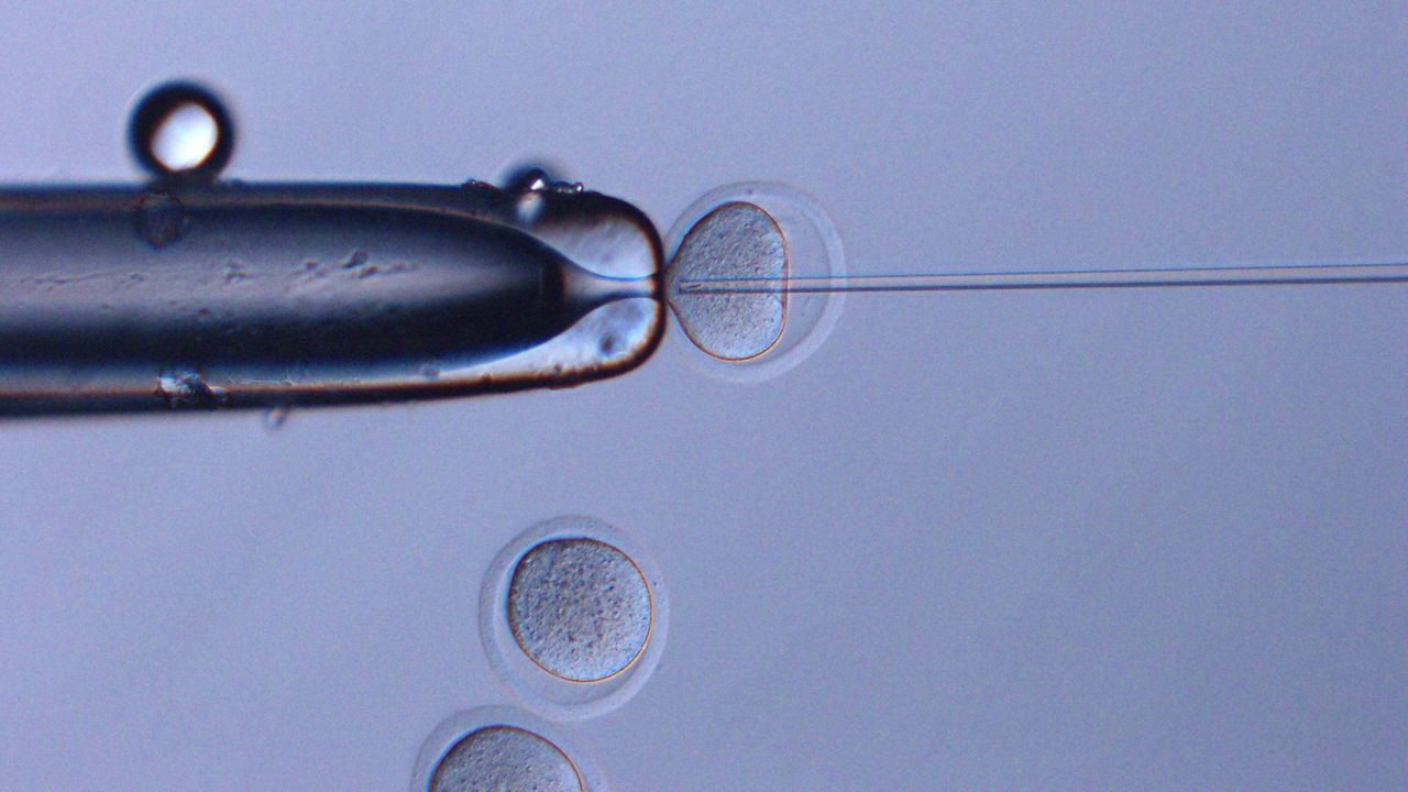 Space sperm were injected into oocytes. This method was called as Intracytoplasmic Sperm Injection (ICSI).